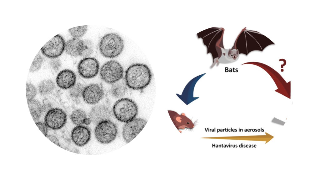 English Sweating Sickness- Hantavirus