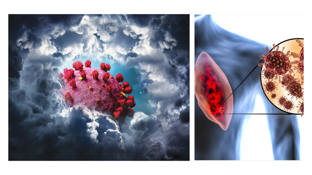 Who will require hospitalization in Covid-19- cytokine storm