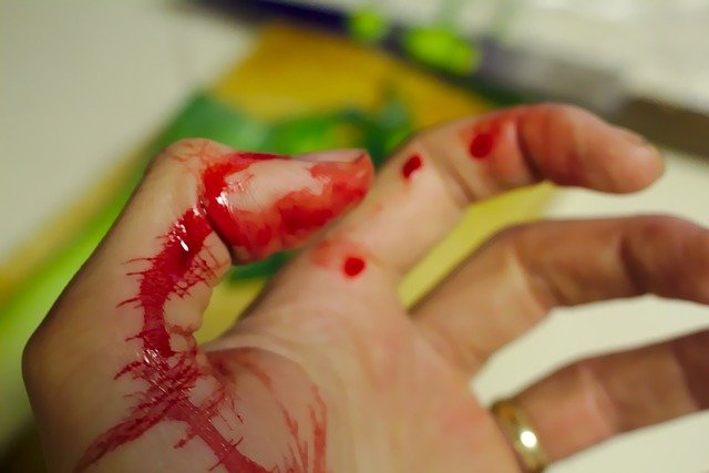 von Willebrand’s Disease: When Bleeding Doesn’t Stop