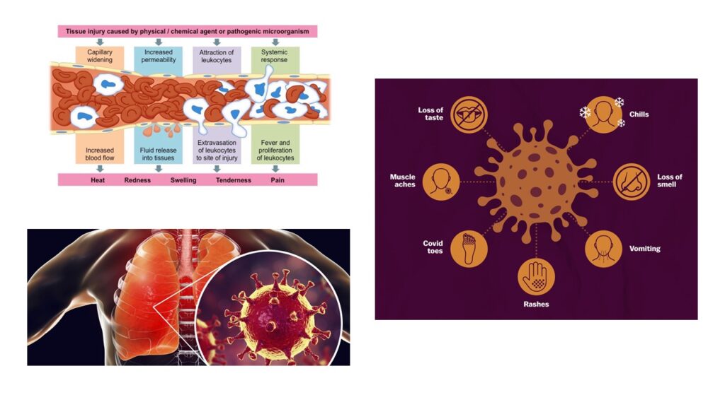 Immune System- Innate