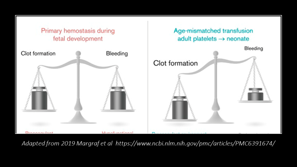 Platelet Transfusion in Children- aged vs young platelets