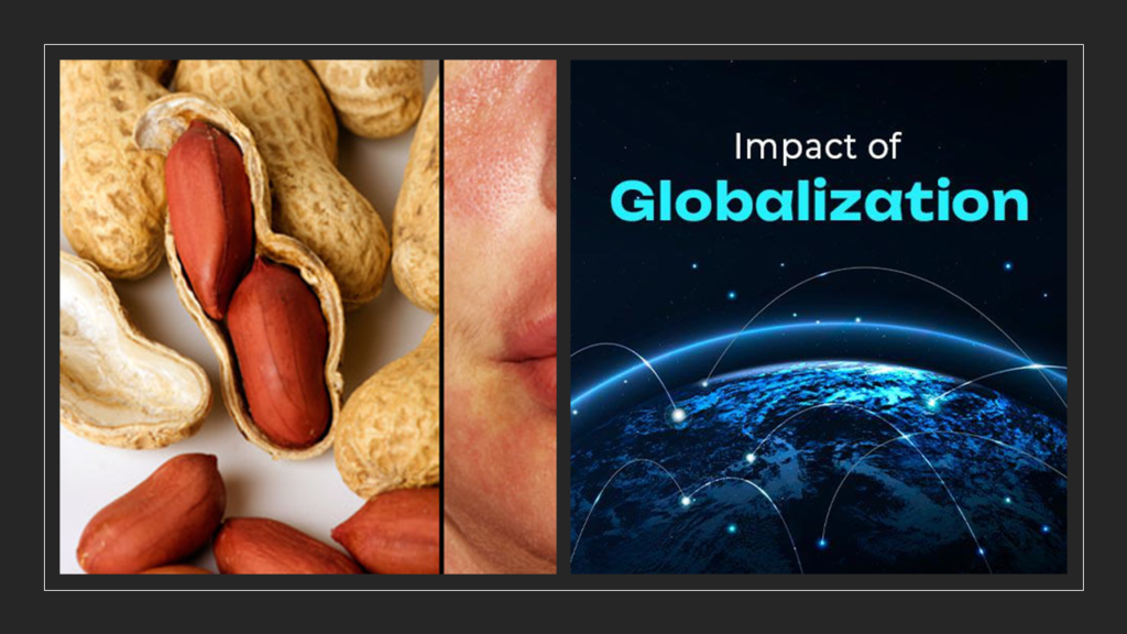 Impact of globalization and Food allergies 
